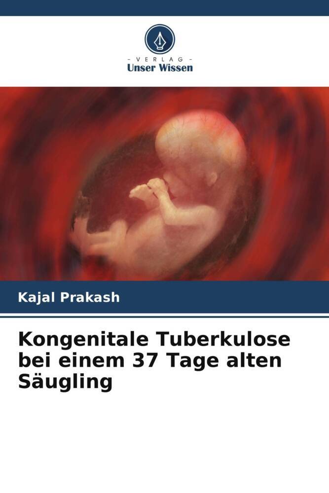 Kongenitale Tuberkulose bei einem 37 Tage alten Säugling