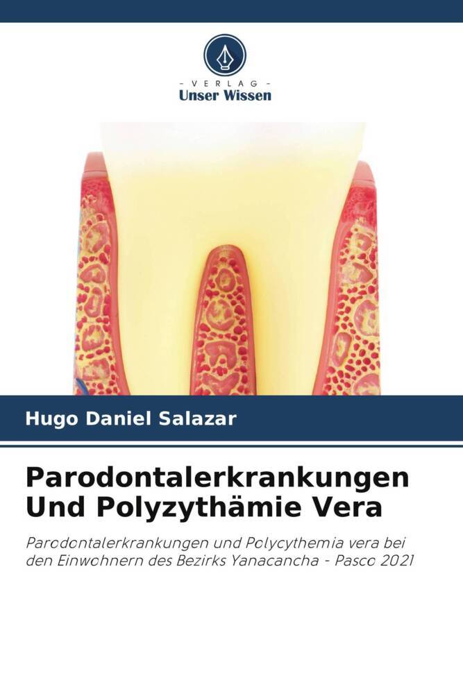 Parodontalerkrankungen Und Polyzythämie Vera