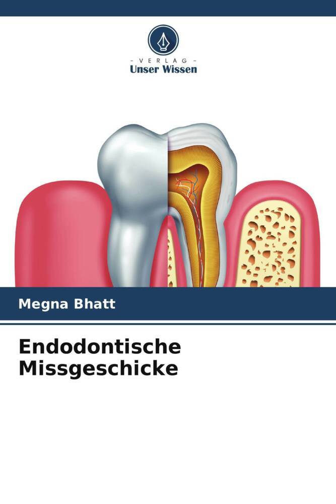 Endodontische Missgeschicke