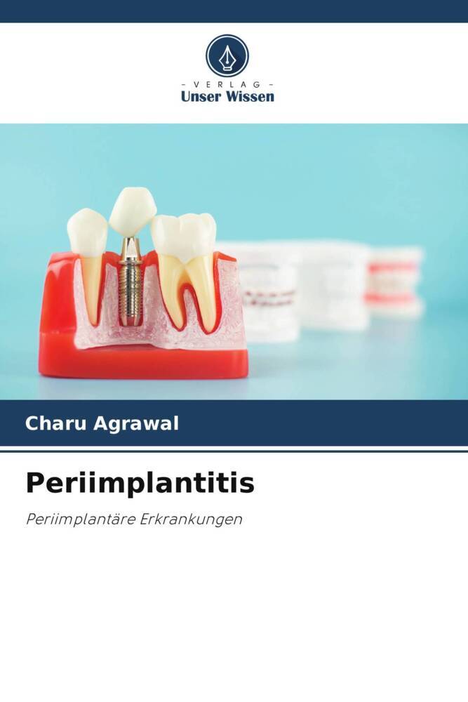Periimplantitis