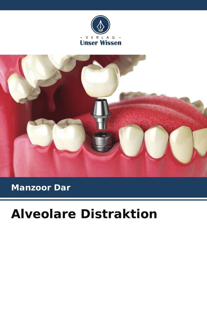 Alveolare Distraktion