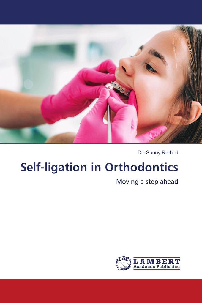 Self-ligation in Orthodontics