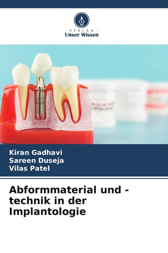 Abformmaterial und -technik in der Implantologie