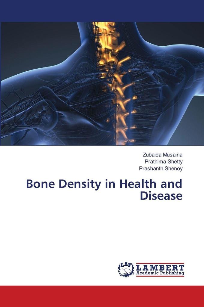 Bone Density in Health and Disease