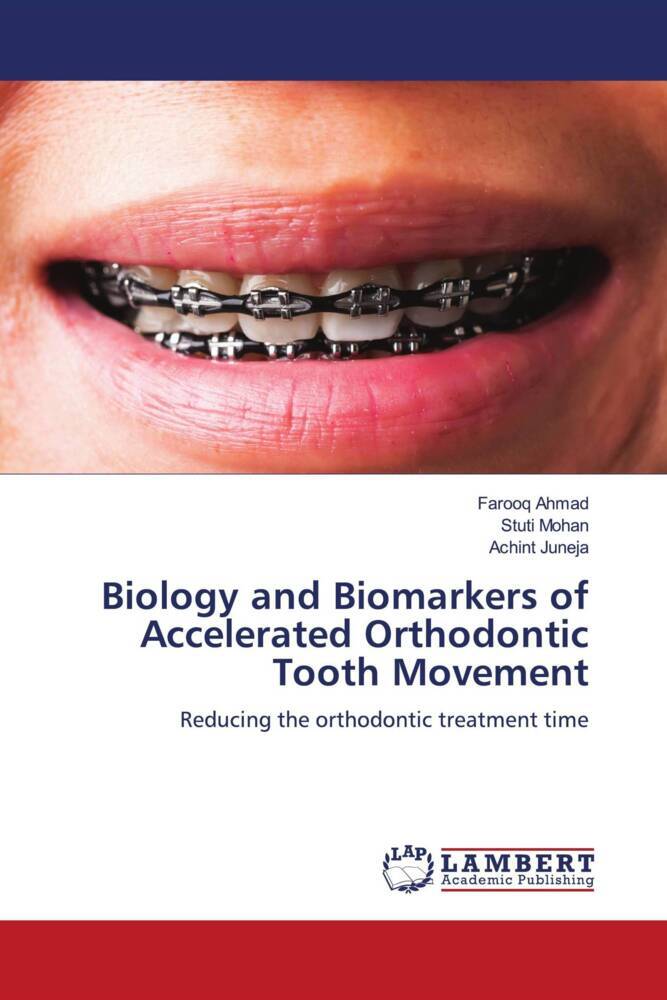 Biology and Biomarkers of Accelerated Orthodontic Tooth Movement