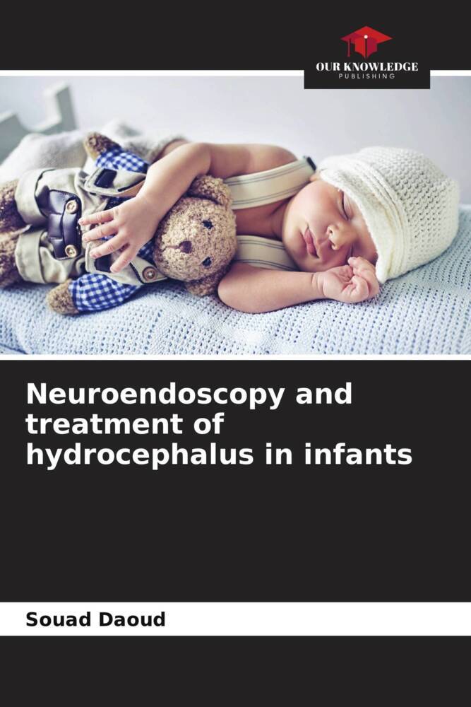 Neuroendoscopy and treatment of hydrocephalus in infants