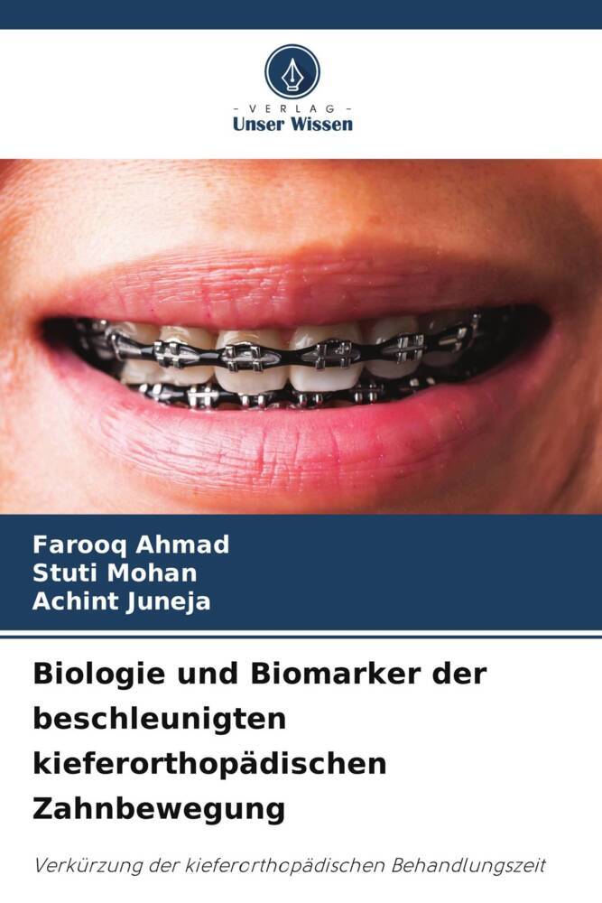 Biologie und Biomarker der beschleunigten kieferorthopädischen Zahnbewegung