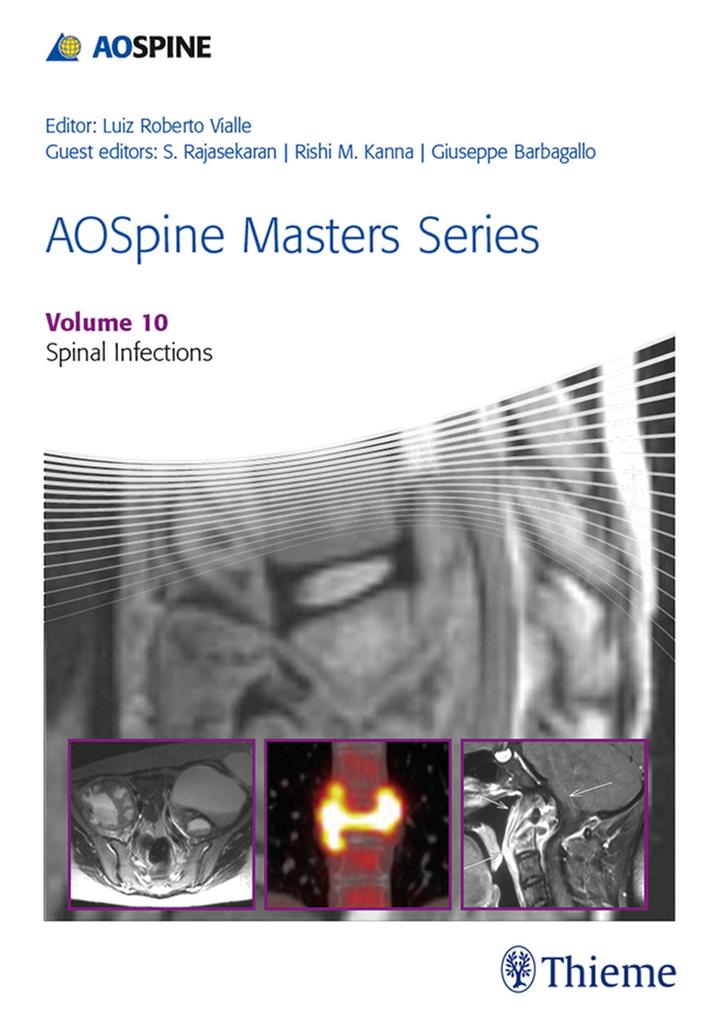 AOSpine Masters Series Volume 10: Spinal Infections