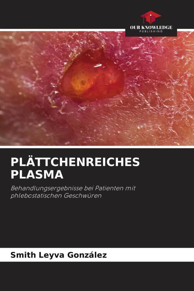 PLÄTTCHENREICHES PLASMA