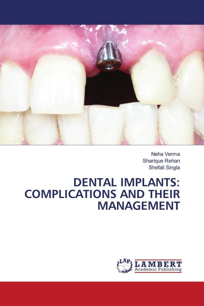 DENTAL IMPLANTS: COMPLICATIONS AND THEIR MANAGEMENT