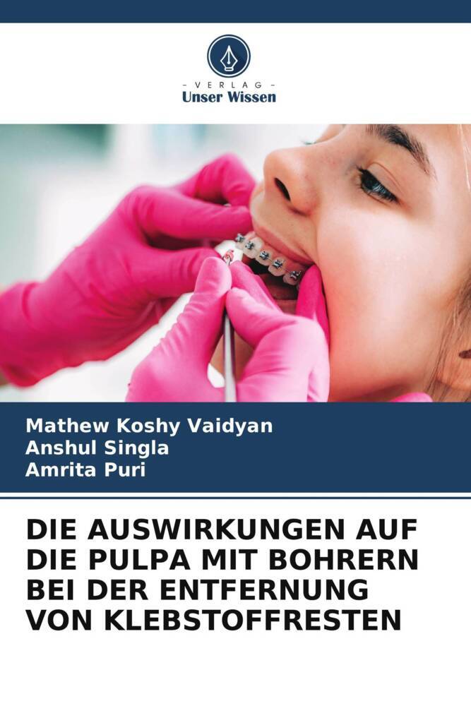 DIE AUSWIRKUNGEN AUF DIE PULPA MIT BOHRERN BEI DER ENTFERNUNG VON KLEBSTOFFRESTEN