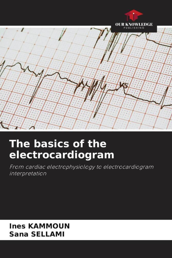 The basics of the electrocardiogram