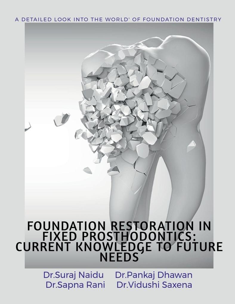 FOUNDATION RESTORATION IN FIXED PROSTHODONTICS