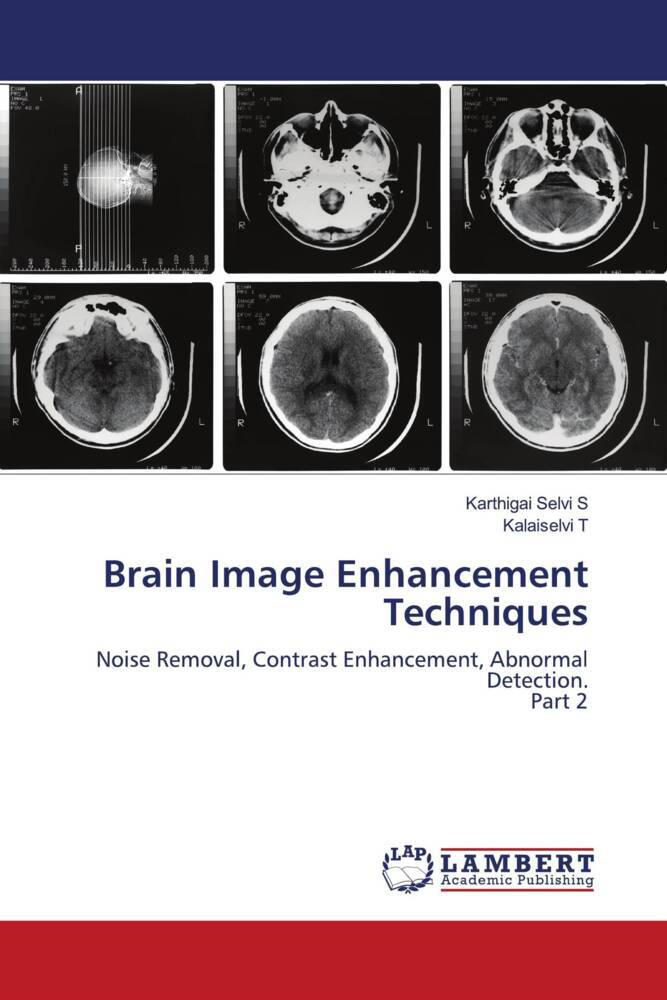 Brain Image Enhancement Techniques