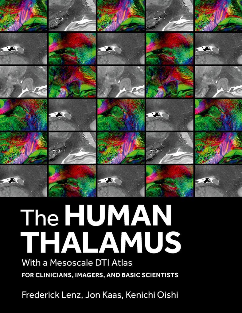The Human Thalamus with a Mesoscale Dti Atlas