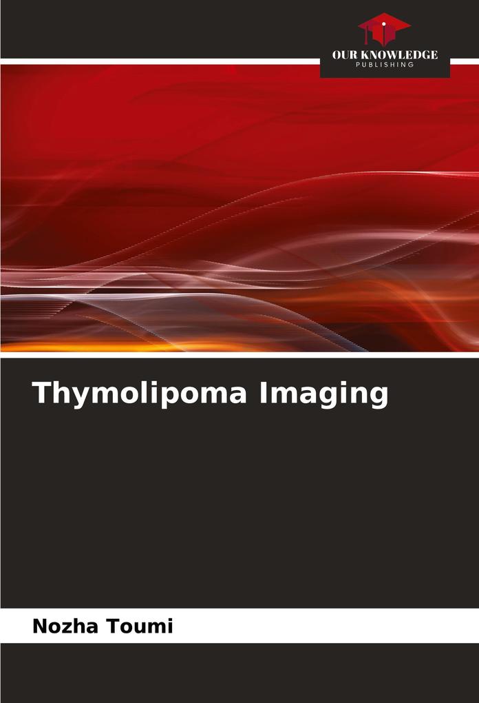 Thymolipoma Imaging