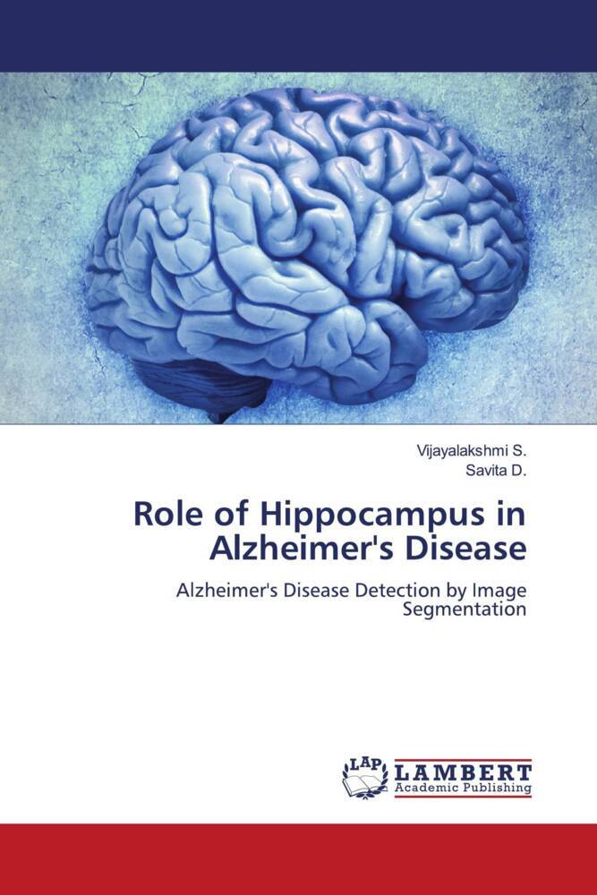 Role of Hippocampus in Alzheimer's Disease
