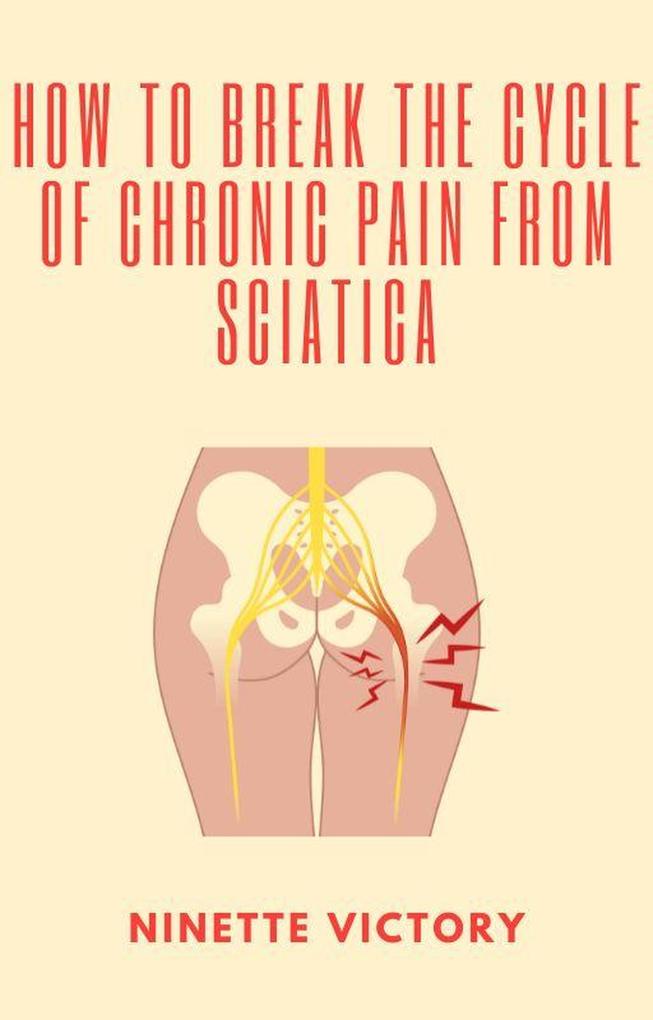 How to Break the Cycle of Chronic Pain from Sciatica