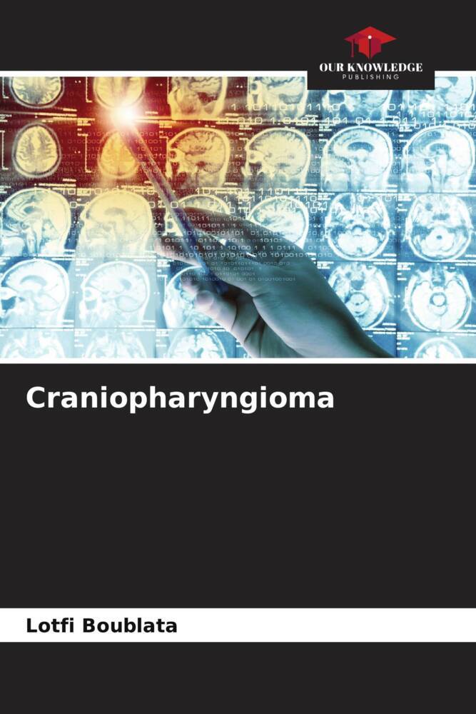Craniopharyngioma