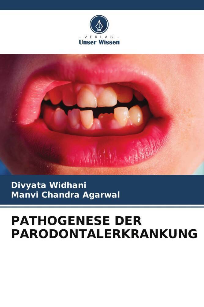 PATHOGENESE DER PARODONTALERKRANKUNG