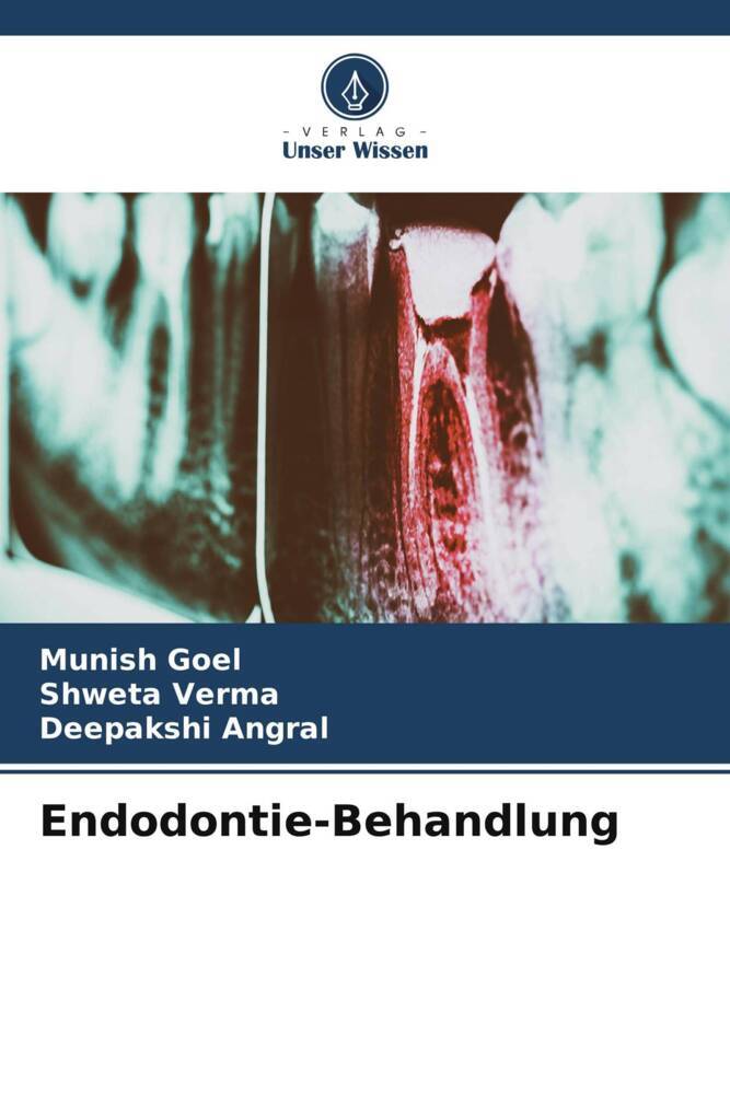 Endodontie-Behandlung