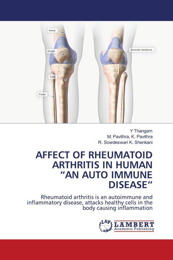AFFECT OF RHEUMATOID ARTHRITIS IN HUMAN 'AN AUTO IMMUNE DISEASE'