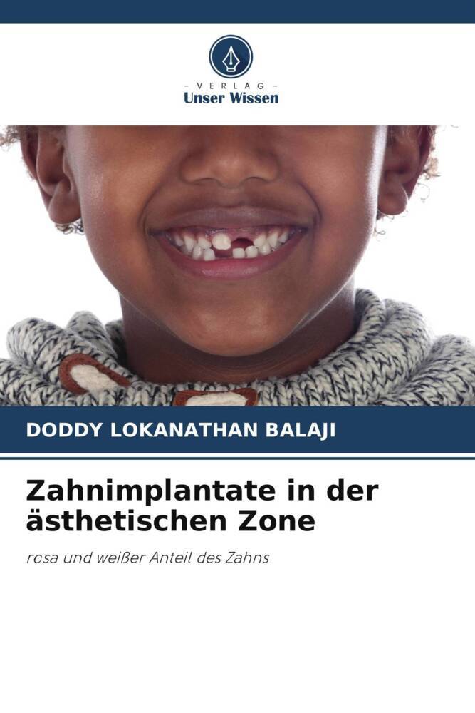 Zahnimplantate in der ästhetischen Zone