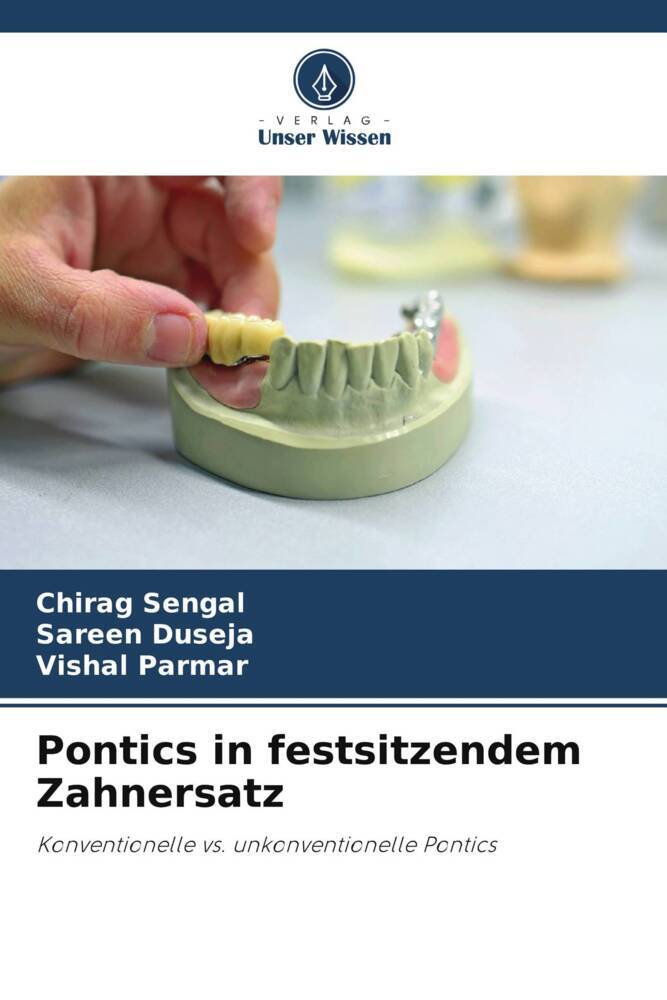 Pontics in festsitzendem Zahnersatz