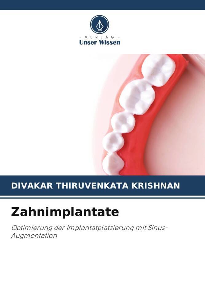 Zahnimplantate
