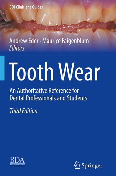 Tooth Wear