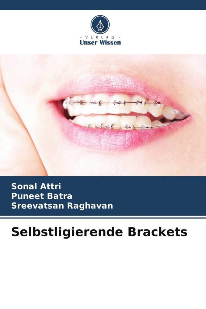 Selbstligierende Brackets