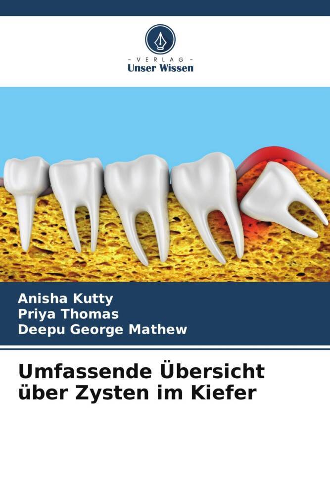 Umfassende Übersicht über Zysten im Kiefer