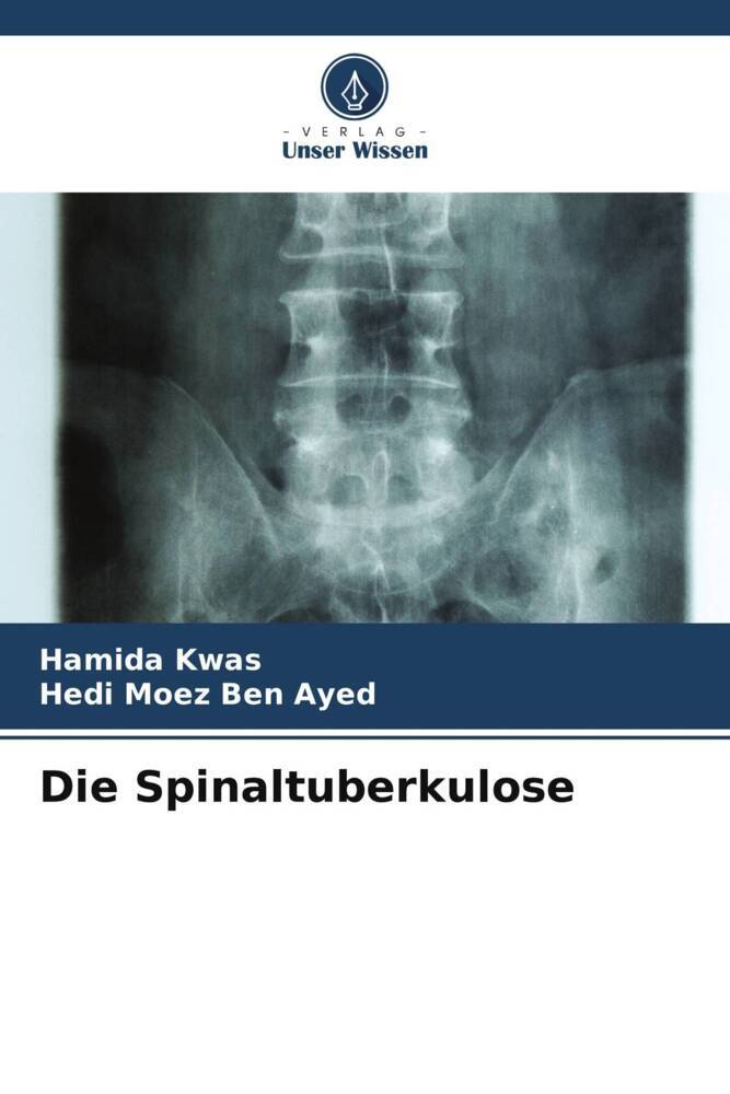 Die Spinaltuberkulose