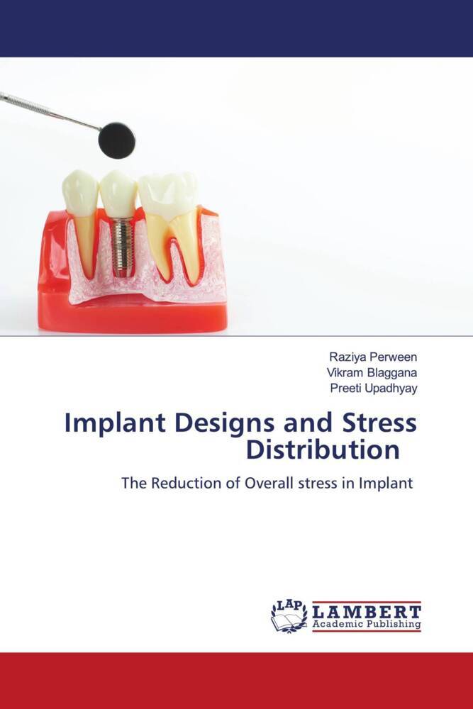 Implant Designs and Stress Distribution
