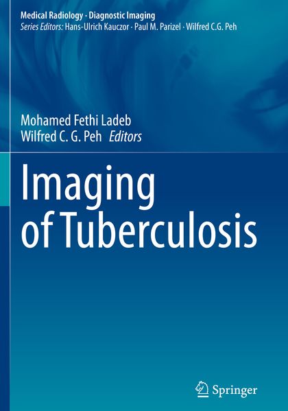 Imaging of Tuberculosis