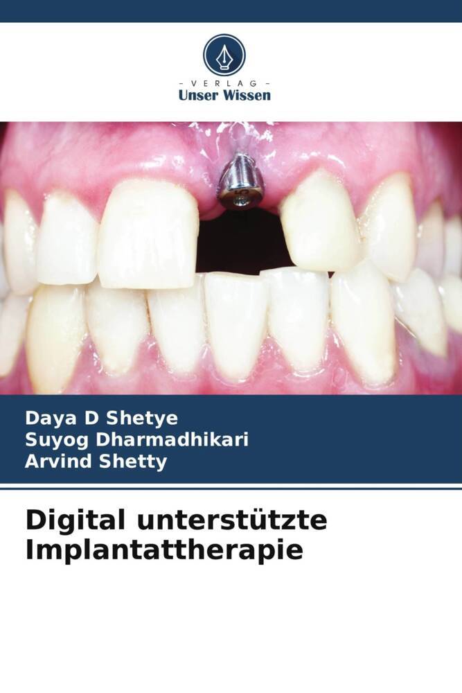 Digital unterstützte Implantattherapie