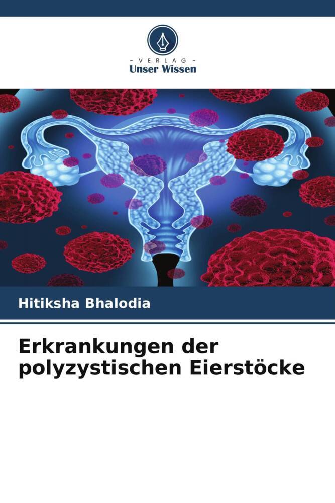 Erkrankungen der polyzystischen Eierstöcke