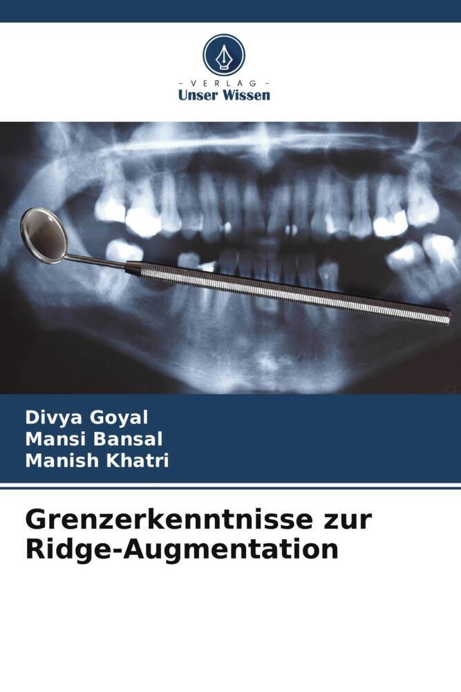 Grenzerkenntnisse zur Ridge-Augmentation