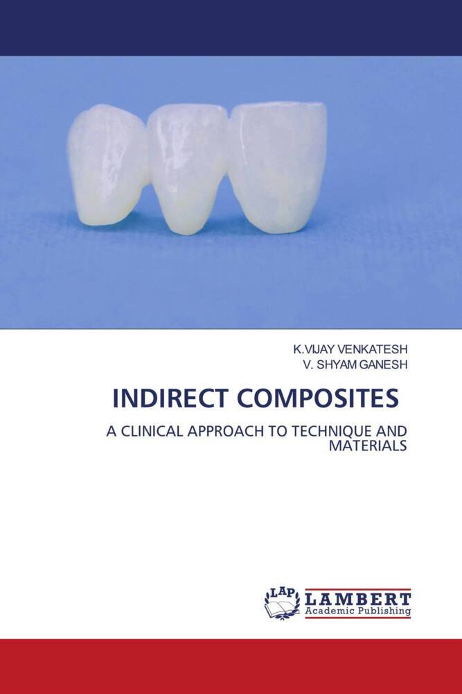 INDIRECT COMPOSITES