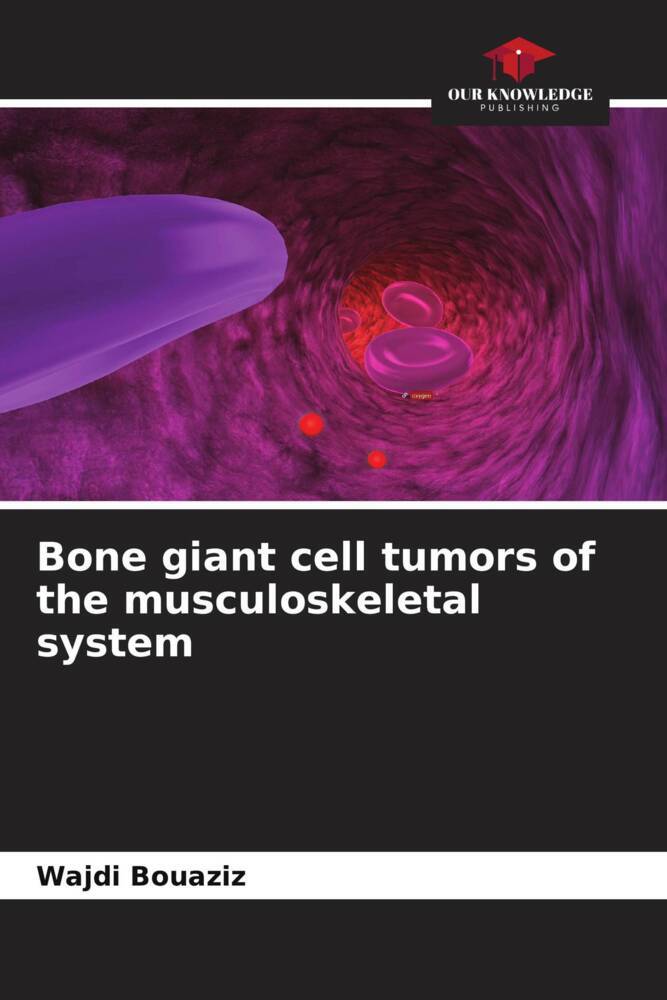 Bone giant cell tumors of the musculoskeletal system