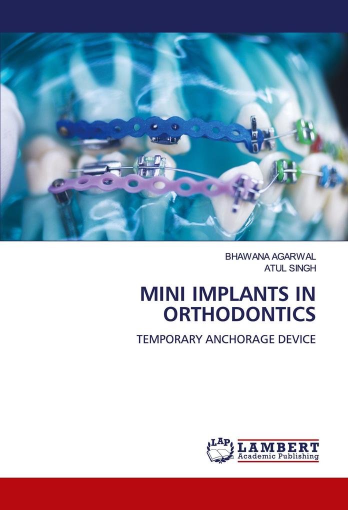 MINI IMPLANTS IN ORTHODONTICS
