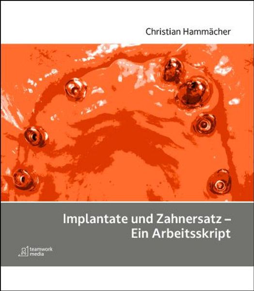 Implantate und Zahnersatz - Ein Arbeitsskript