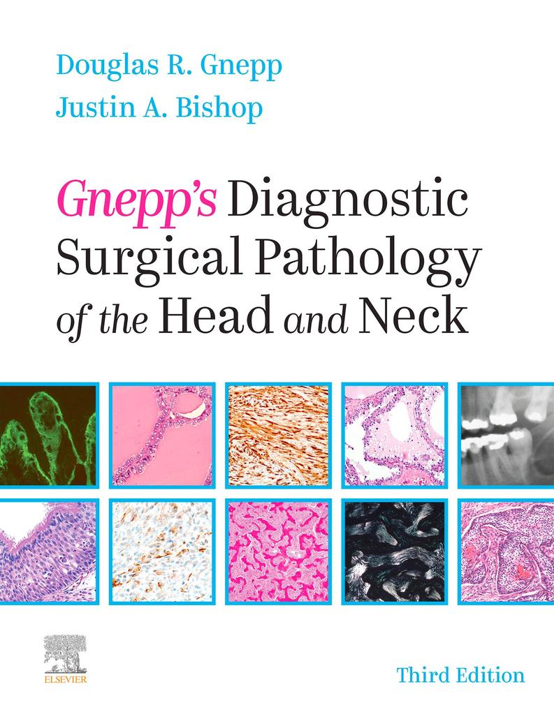 Gnepp‘s Diagnostic Surgical Pathology of the Head and Neck E-Book