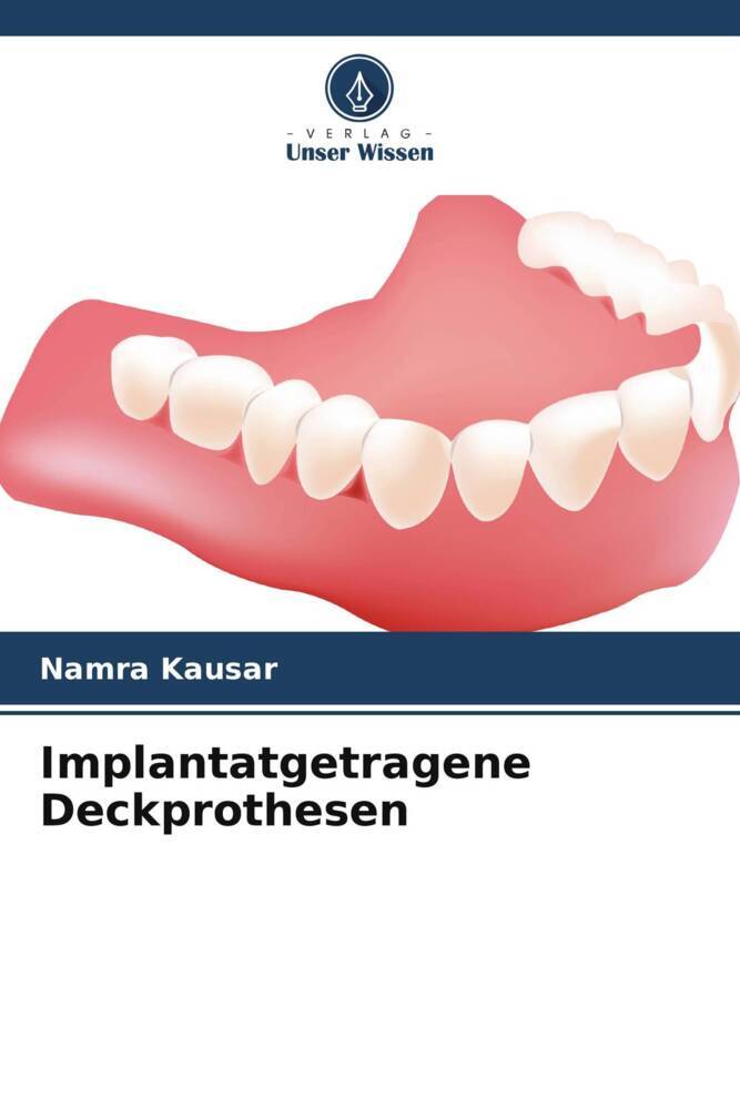 Implantatgetragene Deckprothesen