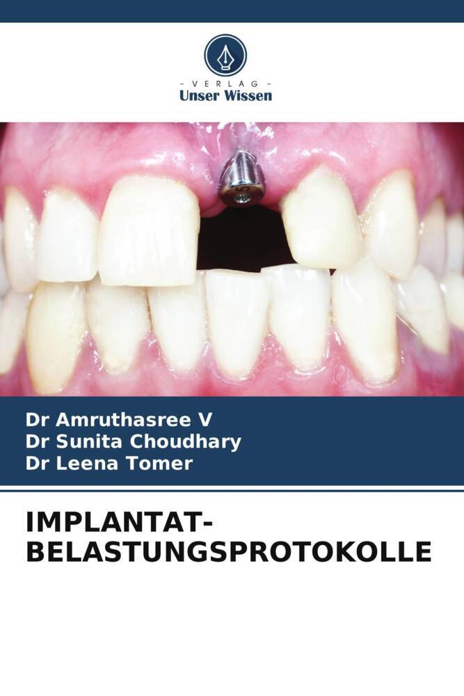 IMPLANTAT-BELASTUNGSPROTOKOLLE