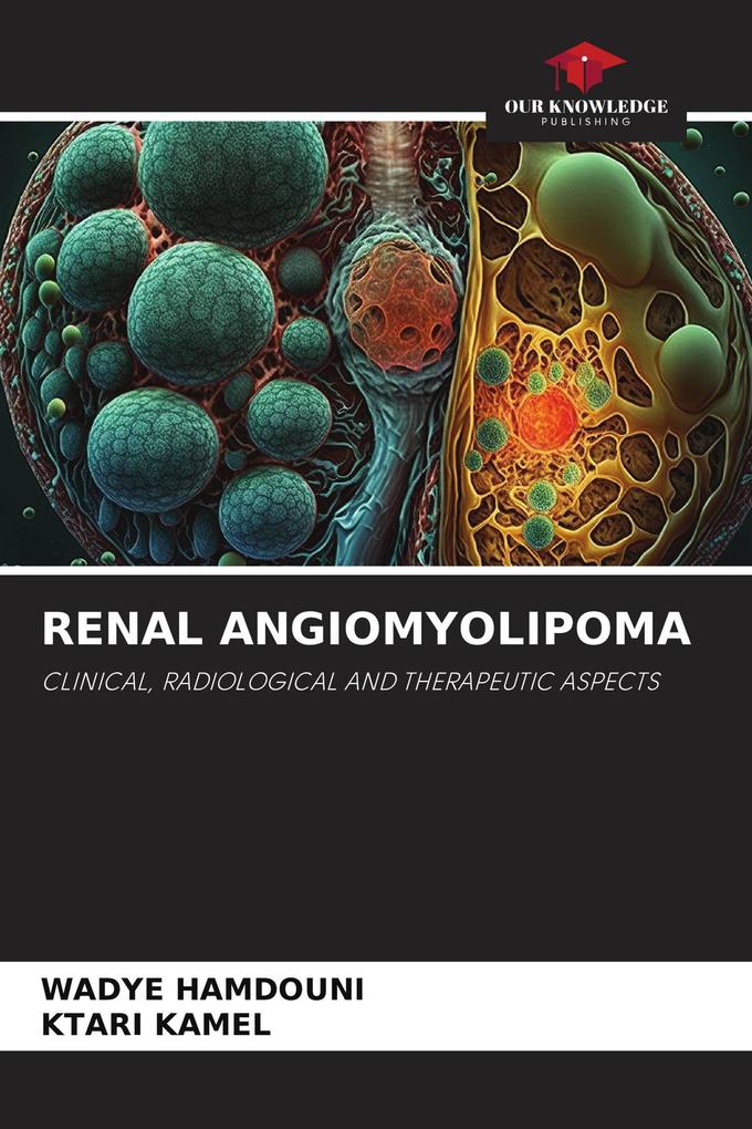 RENAL ANGIOMYOLIPOMA