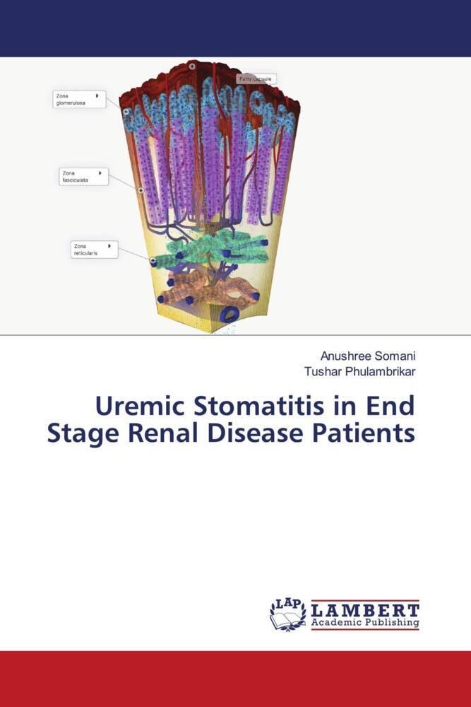 Uremic Stomatitis in End Stage Renal Disease Patients
