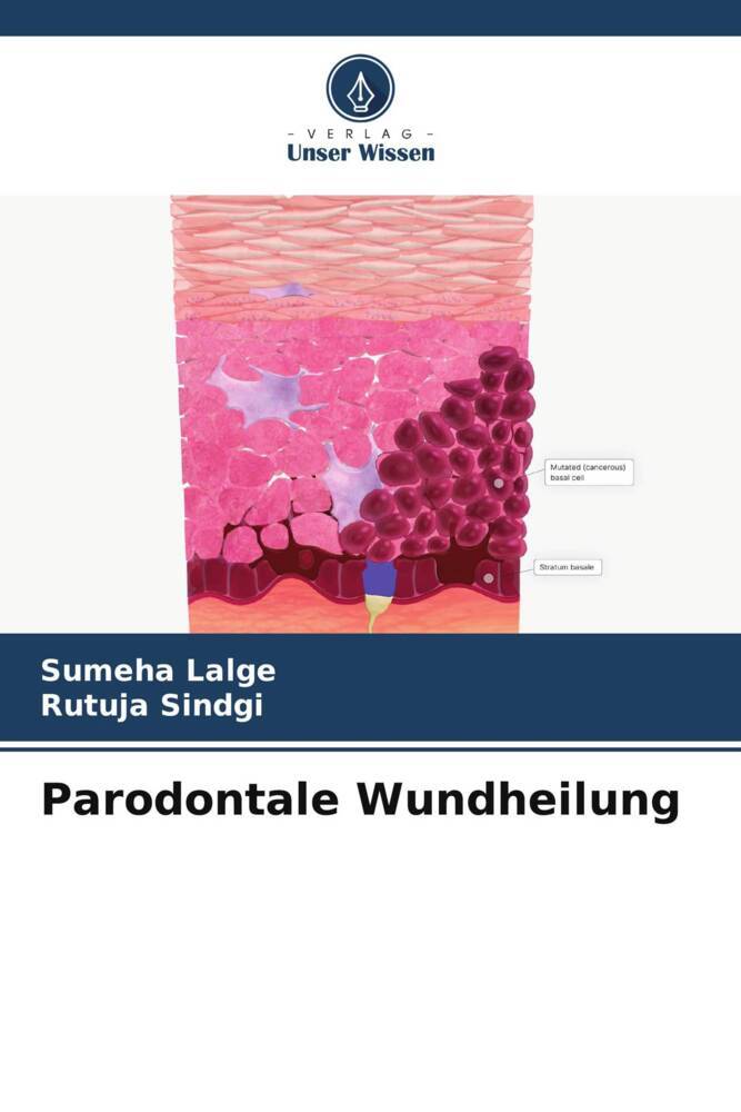 Parodontale Wundheilung