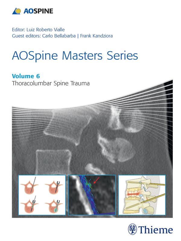AOSpine Masters Series Volume 6: Thoracolumbar Spine Trauma
