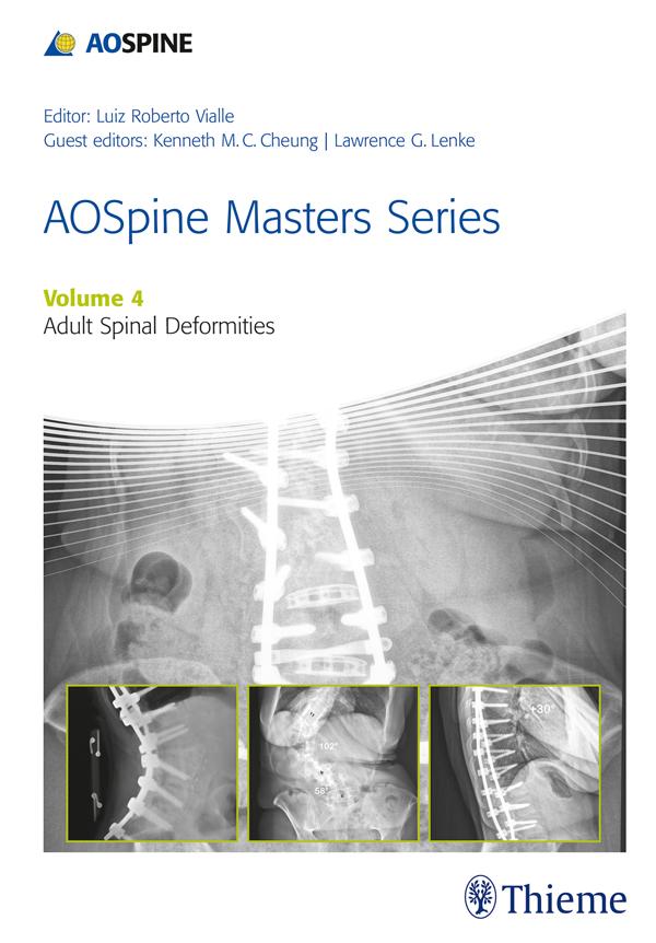 AOSpine Masters Series Volume 4: Adult Spinal Deformities